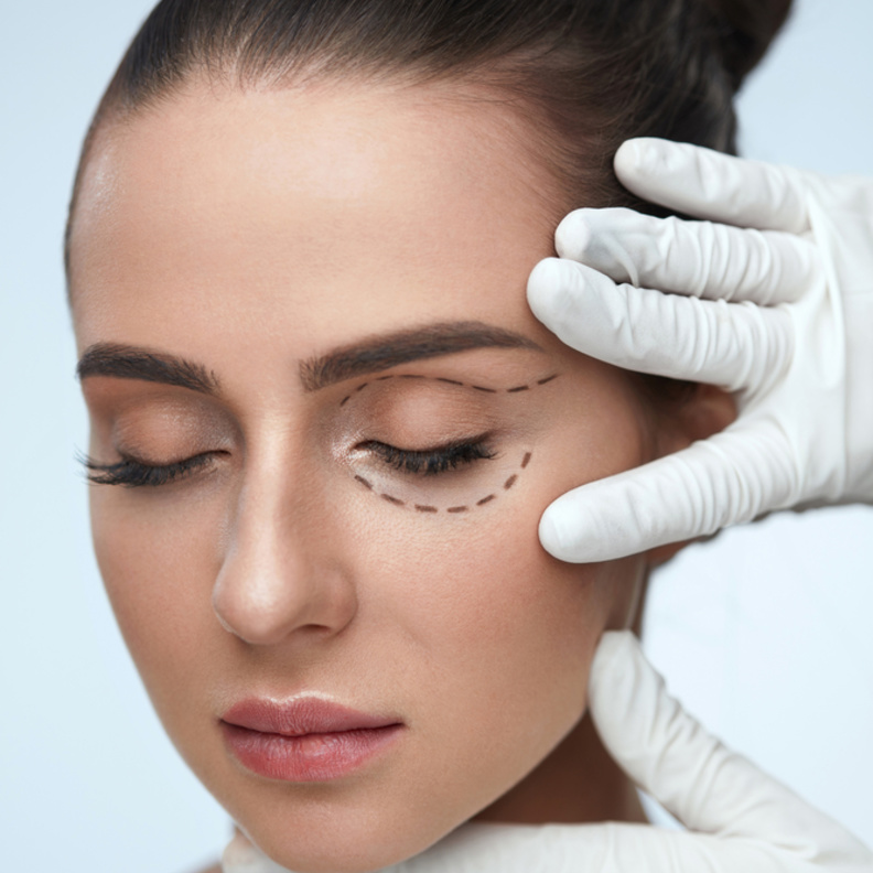 عملية جراحة الجفون