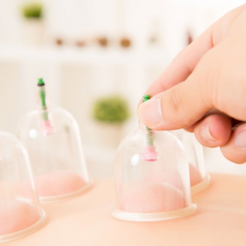 الحجامة تنشط الدورة الدموية