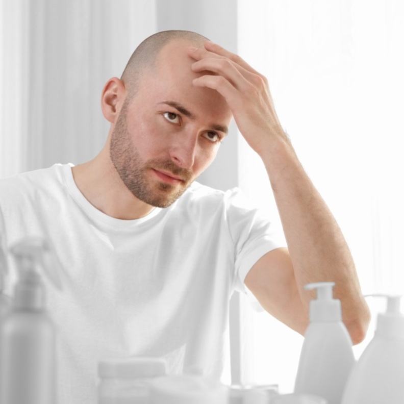 العلاقة بين الصلع والشيب المبكر والنوبة القلبية