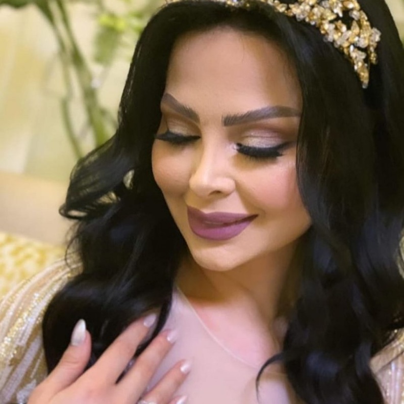 ديانا كرزون