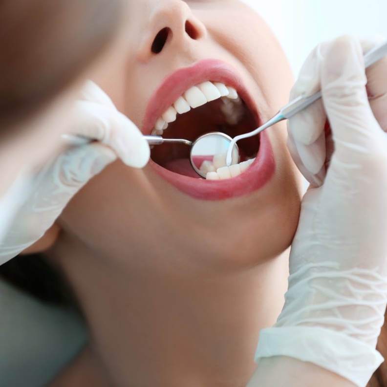 اسباب تسوس الاسنان عند الكبار وطرق الوقاية منها