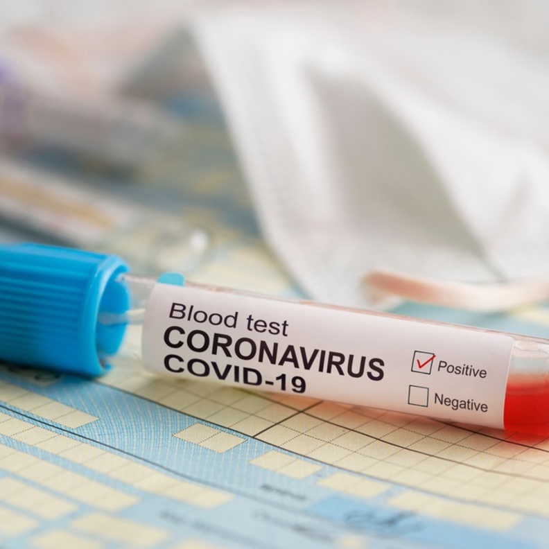 فيروس كورونا يبقى حياً في الهواء لعدة ساعات