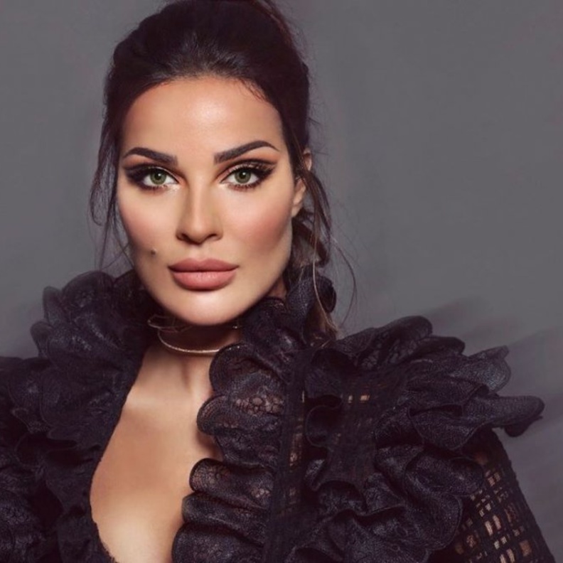  نادين نسيب نجيم بعد عملية تعريض الفك