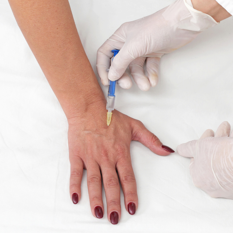 تعرفي على فوائد وأضرار عملية تجميل اليدين لإخفاء عروق اليد