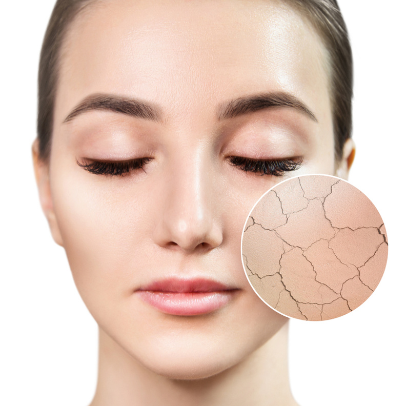 إغسلي وجهك للتخلص من قشرة الوجه