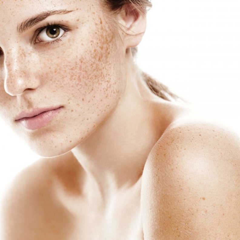 وصفات طبيعية لعلاج النمش وبهتان البشرة قبل بدء رمضان