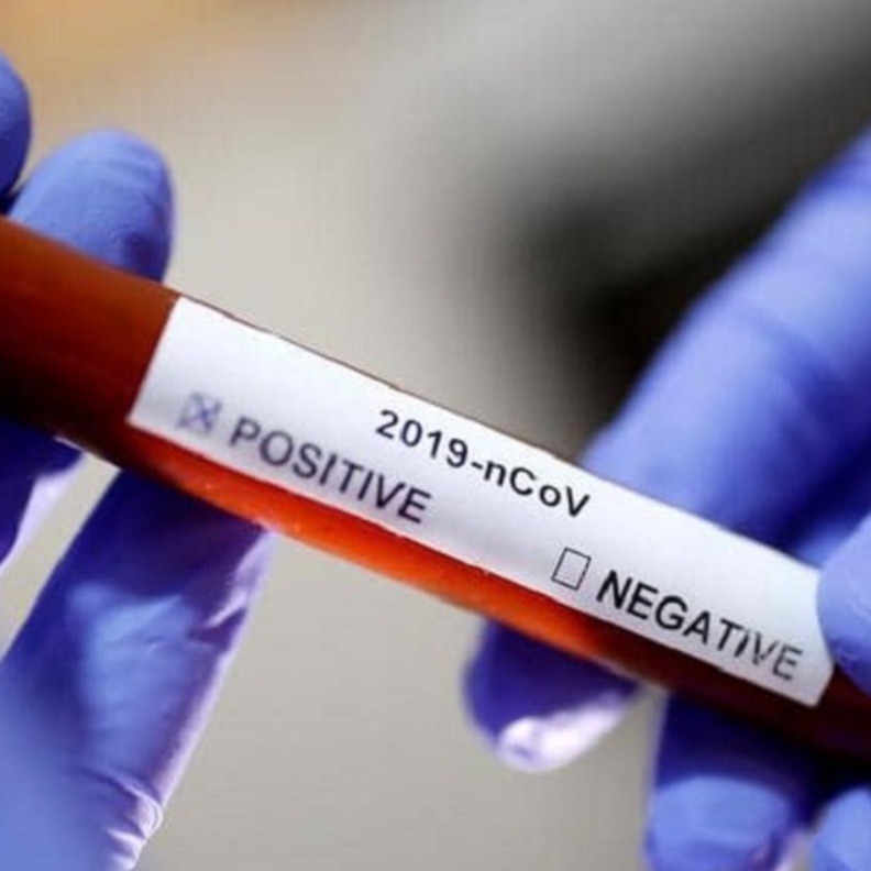  الاجسام المضادة لم تثبت فعاليتها في علاج كورونا