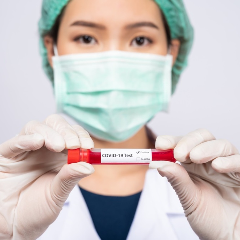 المناعة من فيروس كورونا لا تدوم أكثر من 6 أشهر