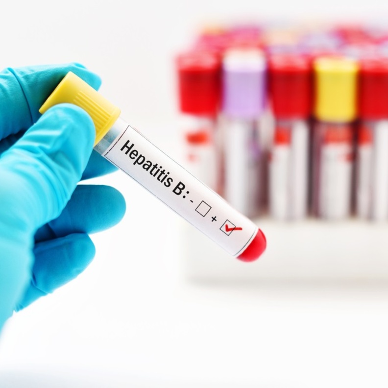 اسباب التهاب الكبد الوبائي ب