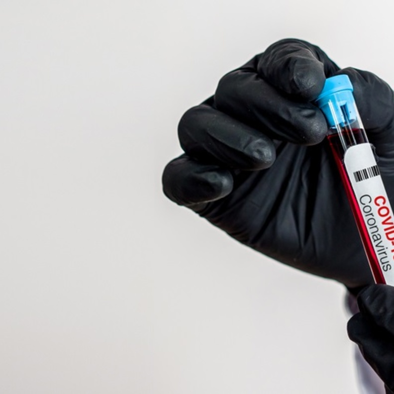 دراسة تنفي وجود علاقة بين عقاقير الأمراض المزمنة وفيروس كورونا 