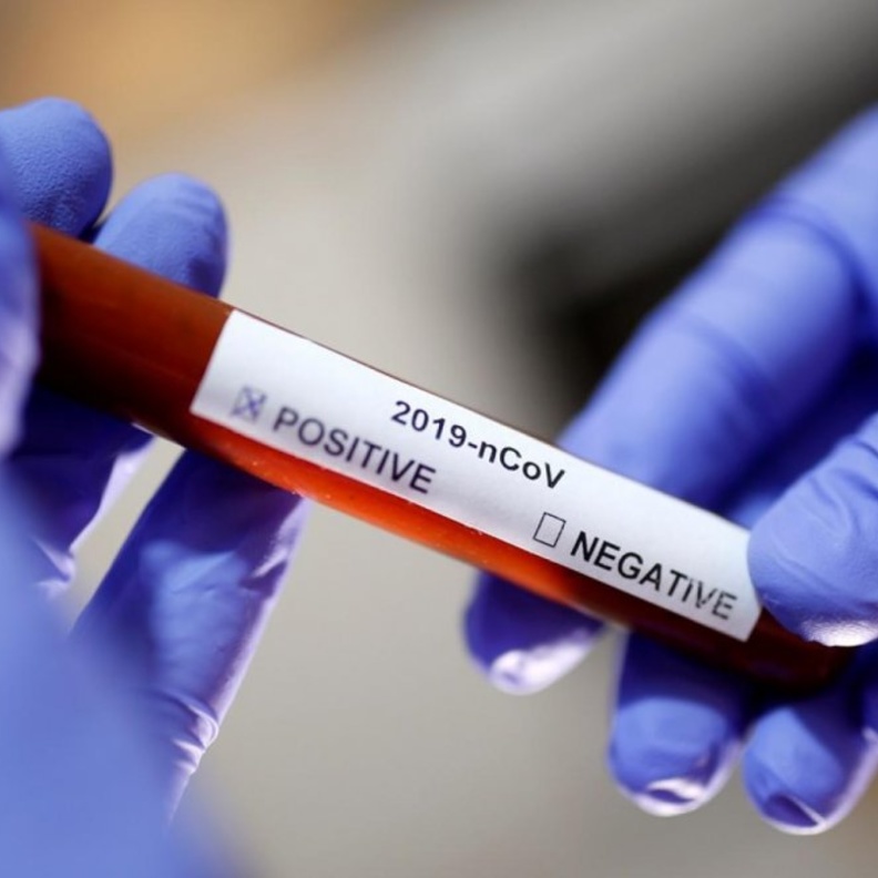  الدراسات تكشف عن أضرار جديدة لفيروس كورونا