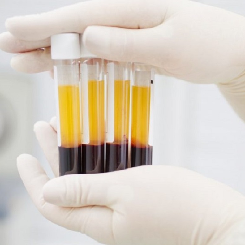 اهم المعلومات عن علاج كورونا ببلازما المتعافين