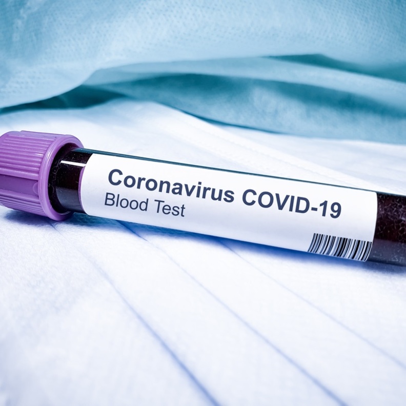 اكتشاف نقطة الضعف القاتلة لفيروس كورونا