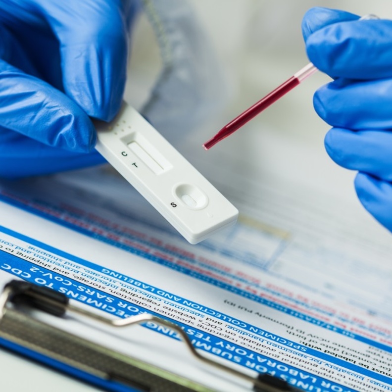 الأجسام المضادة يمكن أن تحمي نصف البشر من فيروس كورونا