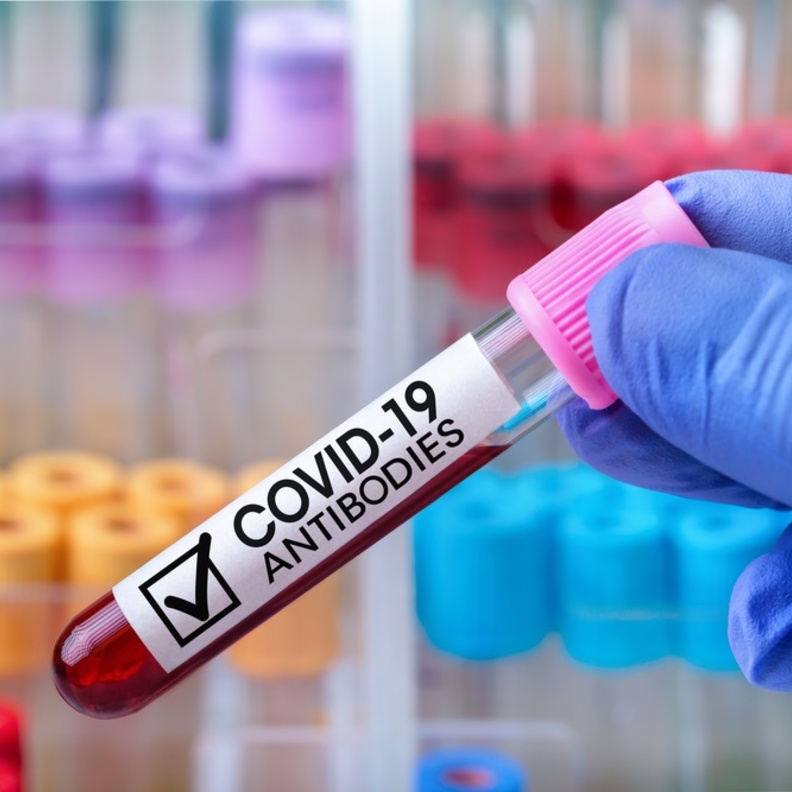 دماء حيوان اللاما تقلل نشاط فيروس كورونا