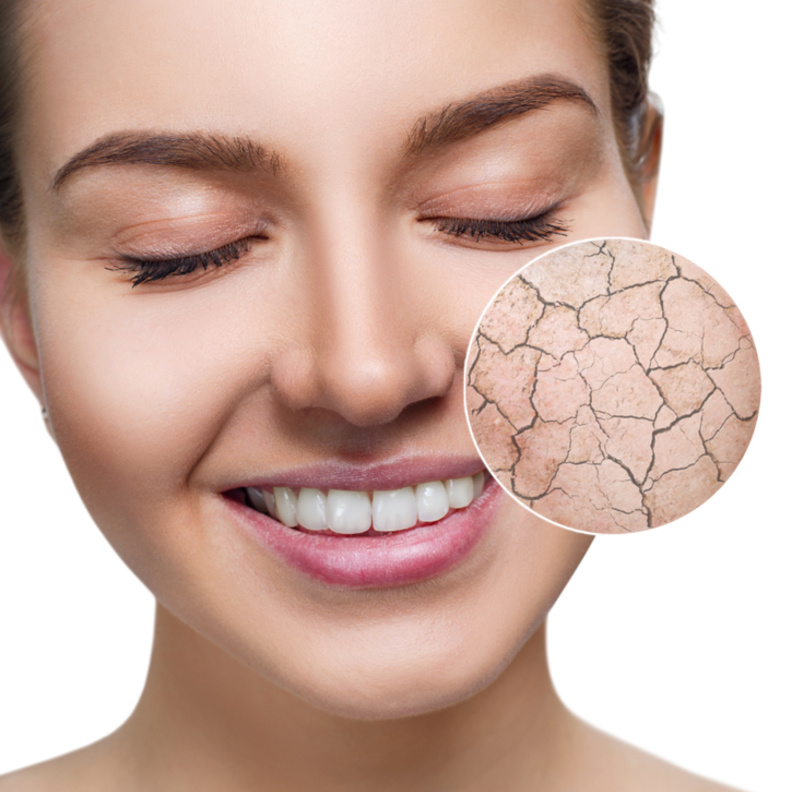 العناية بالبشرة الجافة