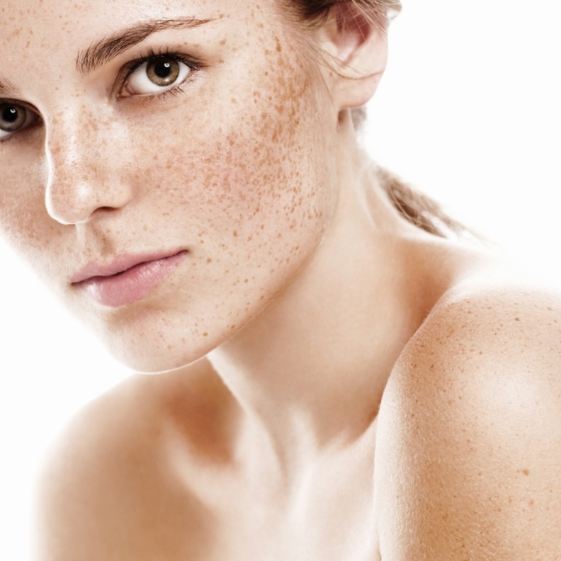 استخدمي زيت اللوز لإزالة النمش