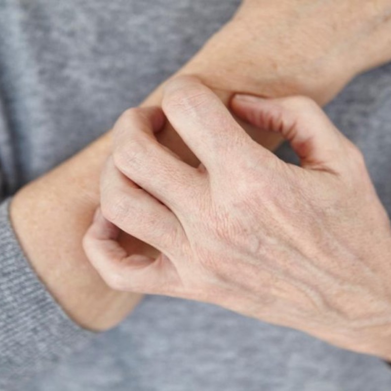 الحكة وإحمرار الجلد من أبرز أعراض الأكزيما الجلدية