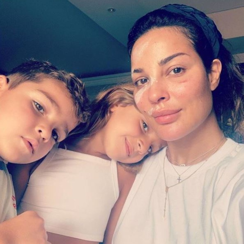 بعد مرور شهر على إصابتها في إنفجار بيروت أطلت نادين نجيم بلوك كاجول مع طفليها