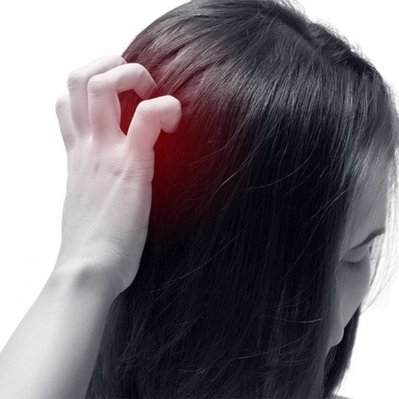  اعراض الاكزيما الدهنية في فروة الرأس واهم اسبابها وطرق علاجها