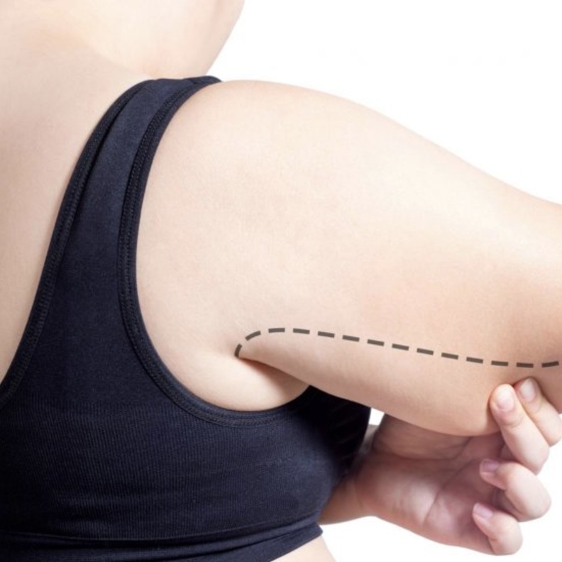  أهم مضاعفات عملية شد الذراعين والآثار الجانبية