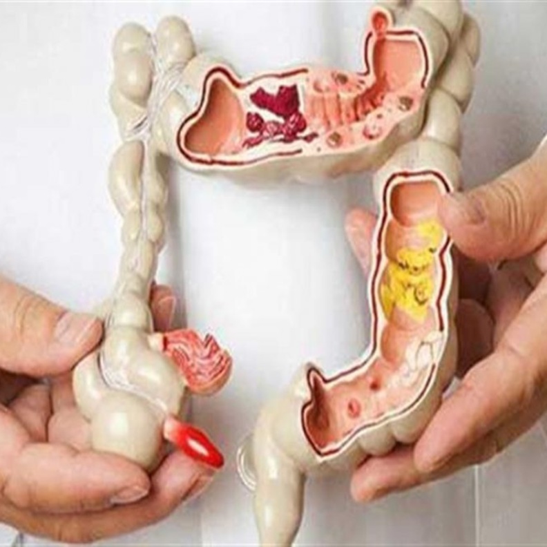  أهمية تنظيف القولون ومخاطره