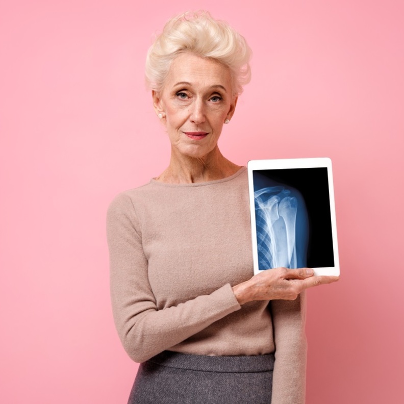 بمناسبة اليوم العالمي لهشاشة العظام نصائح لتعزيز صحة العظام