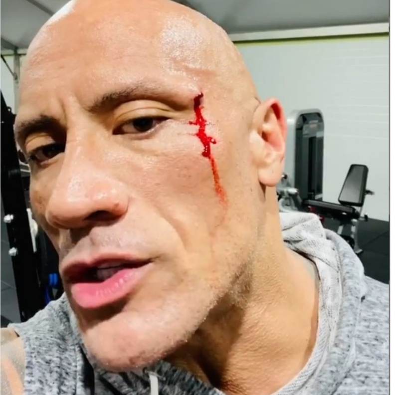 ذا روك يتعرض للاصابة في وجهه