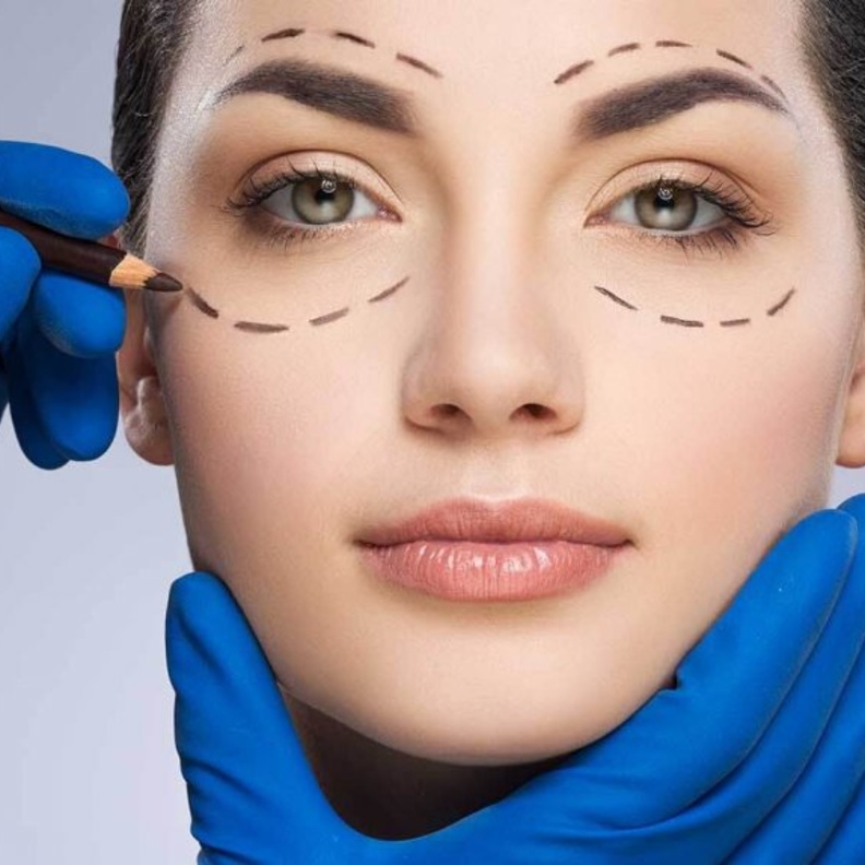 عملية شد الجفون بالليزر تعد من أهم العمليات التجميلية