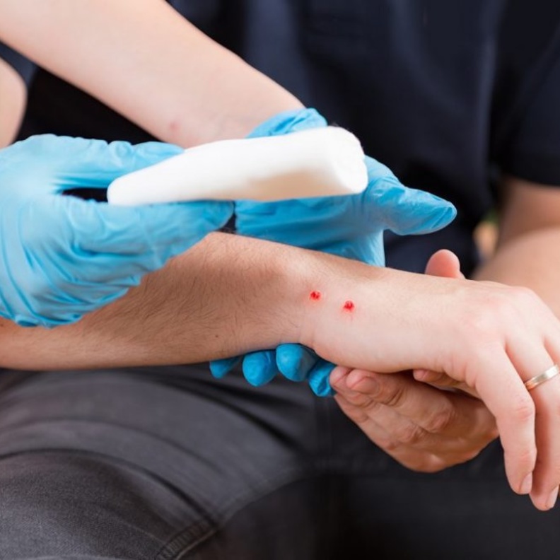 ماهي الاسعافات الاولية للدغة الافعى