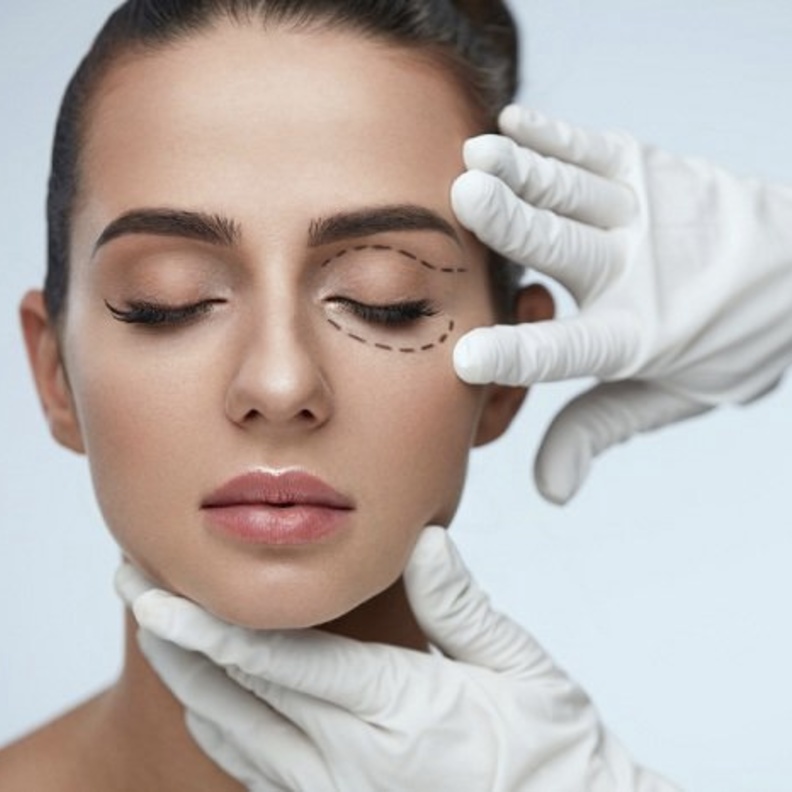 عملية شد الجفون تعالج تدلي الجفون وتنقي مجال الرؤية