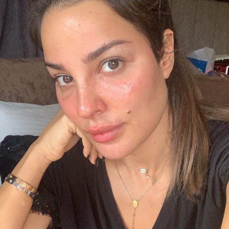 نادين نجيم تروي كواليس اصابتها