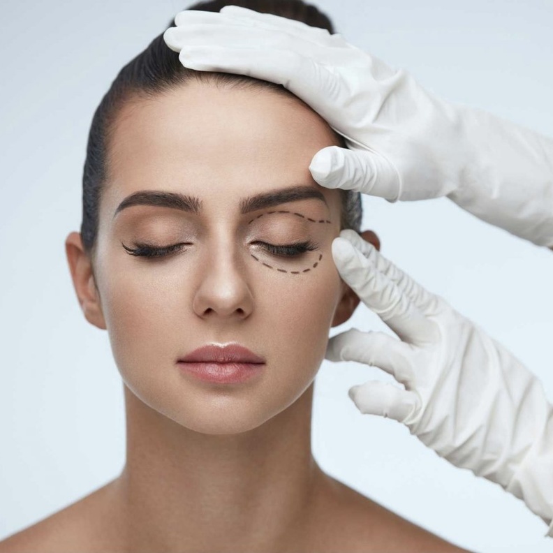 علاج الهالات السوداء حول العينين من خلال عملية شد الجفون