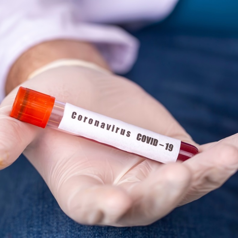 تحذير من تزايد المصابين بكورونا خلال الشهرين القادمين