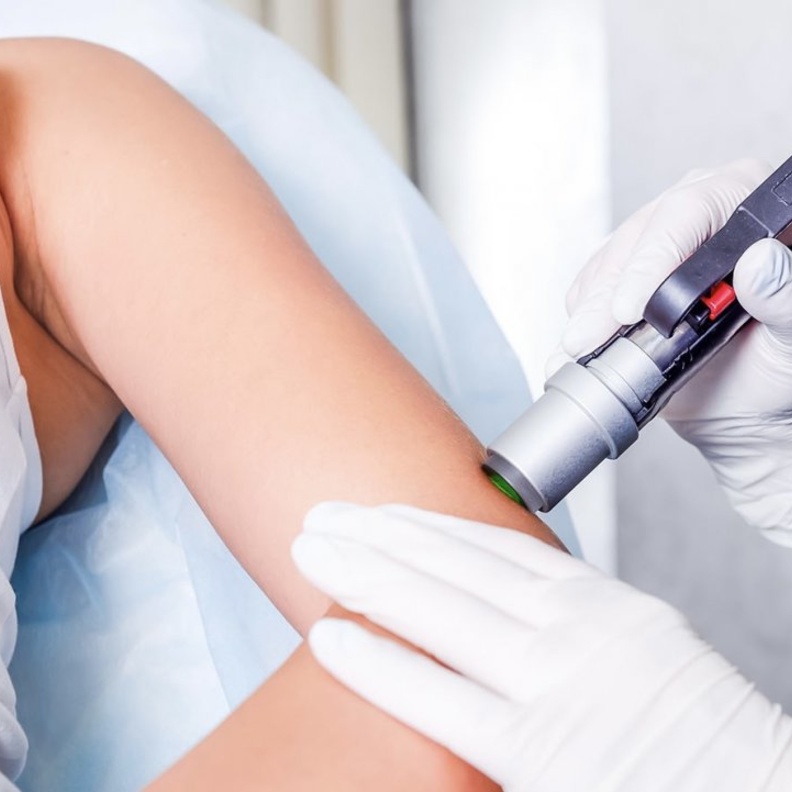 مضاعفات عملية نحت الجسم بالليزر قليلة جداً