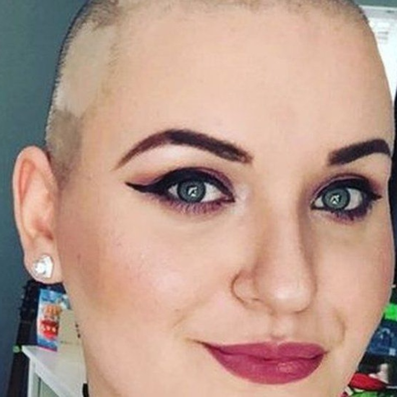 ادعت كذبا أنها مريضة بالسرطان لجمع اموال حفل الزفاف