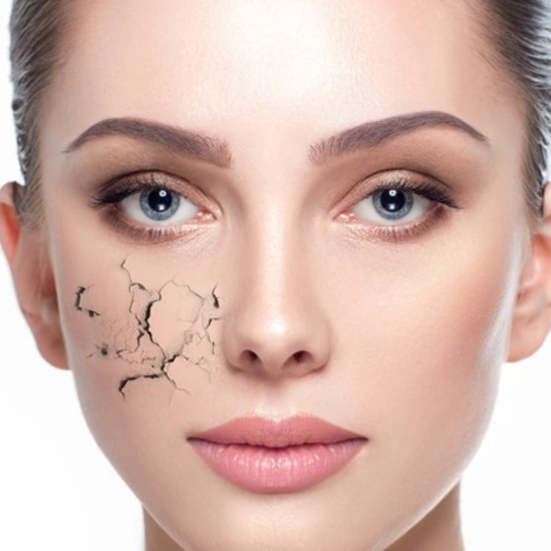 طريقة عمل ماسك التفاح والجلسرين للبشرة الجافة