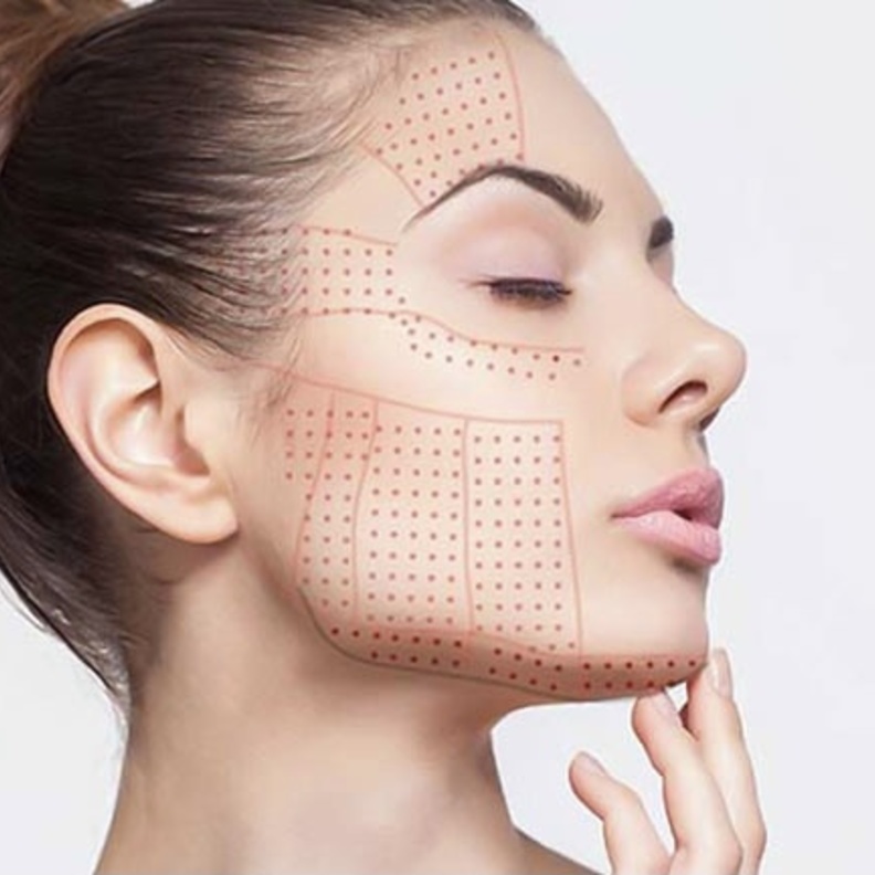 تعد تقنية الهايفو جزءاً من العلاجات المضادة للشيخوخة