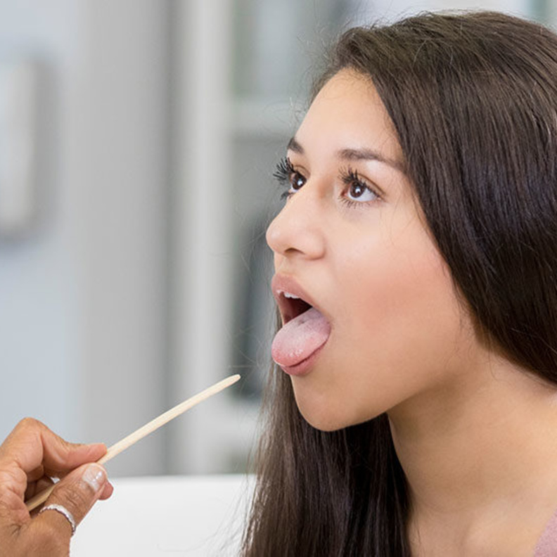  ماهي اسباب تغير اللسان الى الاصفر ومضاعفات ذلك