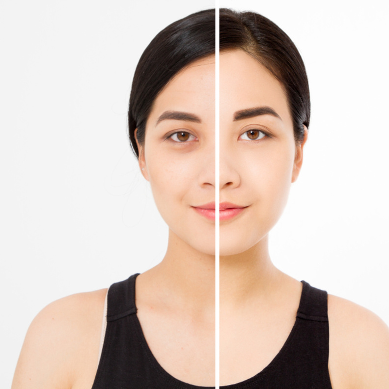 "الهالات السوداء"  تتحول  لصيحة جمالية رائجة