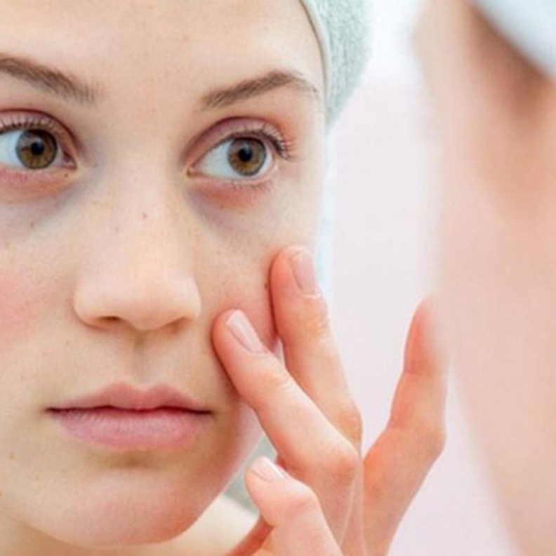 لاتصدقوا هذه الأمور عن الذئبة الحمراء