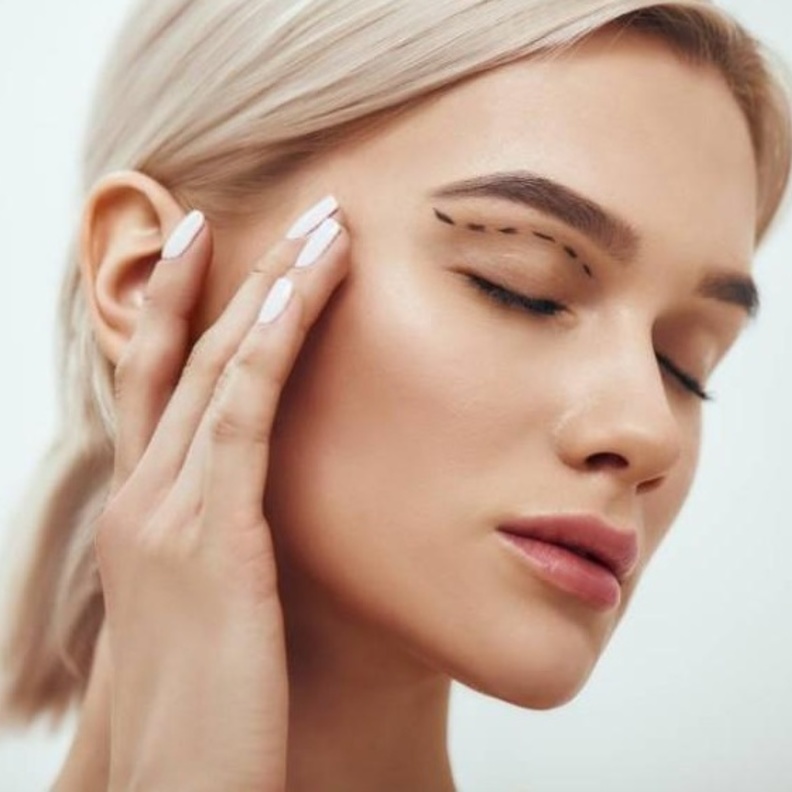 جراحة الجفن، لتحسين مظهر أو وظيفة الجفون