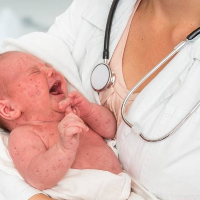 ازدياد حالات وفاة الأطفال بين مراحل العمليات