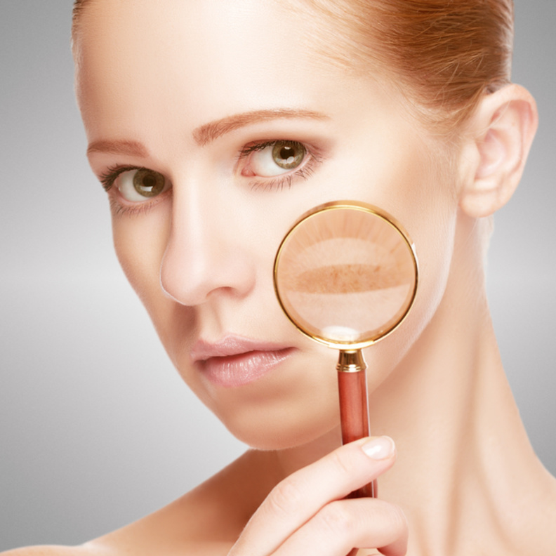 نصائح جمالية عند استخدام طريقة بدة الشيا والزنجبيل للتخلص من الكلف واثاره