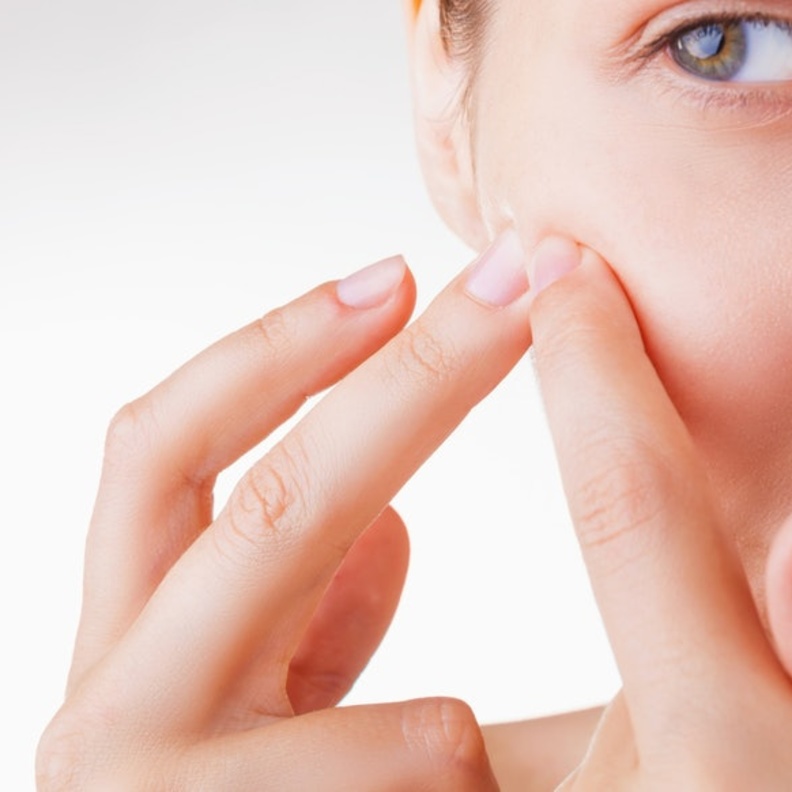 اسباب غير متوقعة لظهور حب الشباب