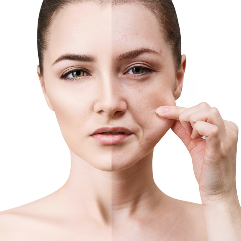  عملية شد الوجه مفيدة في مكافحة علامات الشيخوخة في الوجه والرقبة