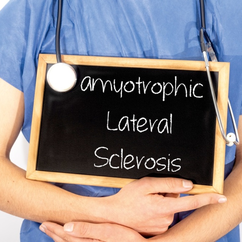 اسباب واعراض مرض التصلب الجانبي الضموري وطرق علاجه