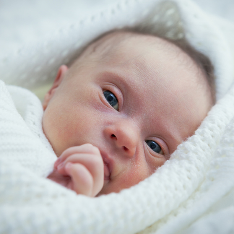 كيف يظهر شكل الطفل المنغولي في السونار