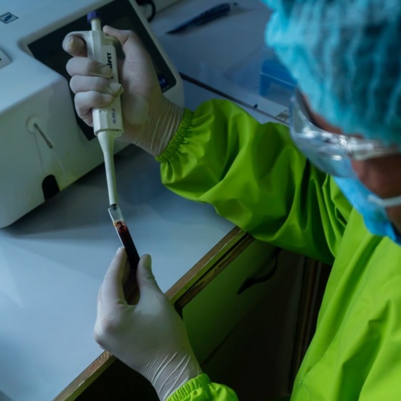 اكتشاف جسم مضاد يحيد طفرات فيروس كورونا Prasesh Shiwakoti (Lomash)