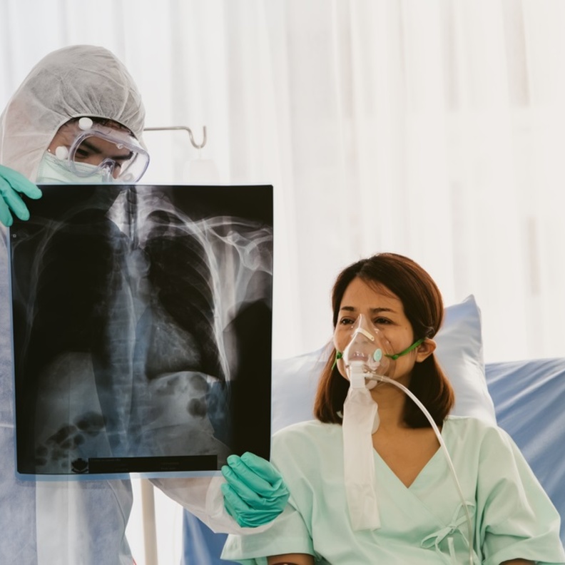 متى يكون جهاز التنفس الصناعي ضروري لمريض كوفيد 19